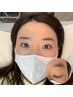 【HBL美眉パーマ】生え癖にお悩みの方に☆ ブロウリフトで毛並み感のある眉に