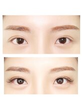 ボアップ(boappu)/マツエク