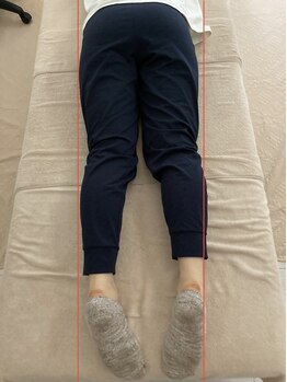 パーソナルケア ボーテ(PERSONAL CARE BEAUTE)/アフター 2