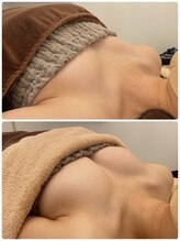 美人バスト 札幌店/バストアップ×育乳◇症例◇