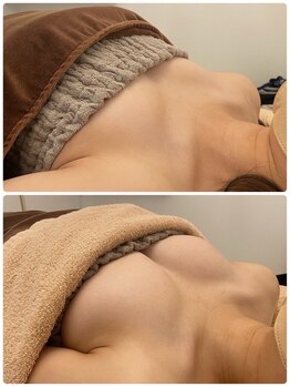 美人バスト 札幌店/バストアップ×育乳◇症例◇