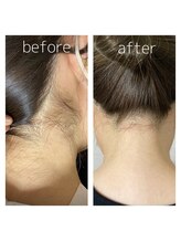 テンピスモ(tempismo)/before after