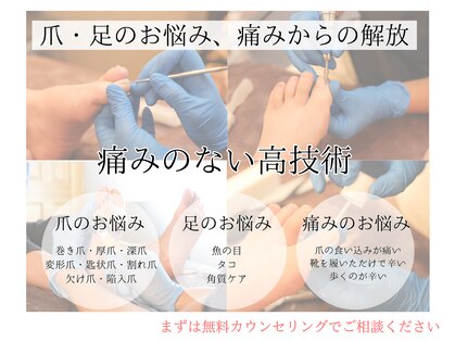 巻き爪バスター 与野店の写真