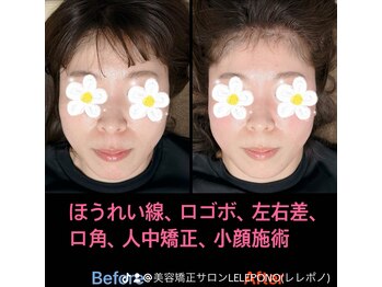 美容矯正サロン レレポノ(LELEPONO)/