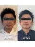 【毎月のメンテナンスに★】《小顔矯正》45分（¥8,800）