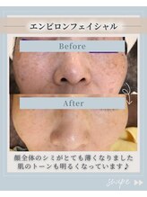 オディエ(Odier)/エンビロントリートメントシミ