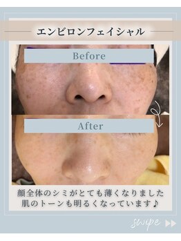 オディエ(Odier)/エンビロントリートメントシミ