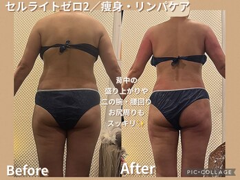 ボディリカバリー(Bodyリカバリー)/ビフォーアフター