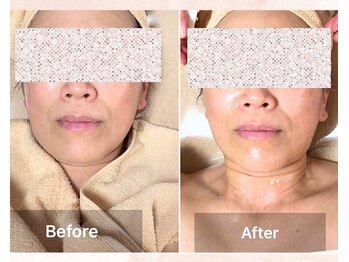 セレーノ/ビフォーアフターのご紹介