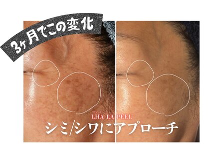 アマランサス(Amaranthus)の写真