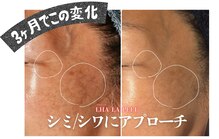 アマランサス(Amaranthus)