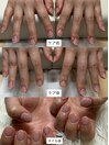 ネイルケア後→シンプルネイル
