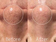 マイナプラ 表参道(myna+)/