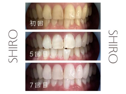 シロ(SHIRO)の写真