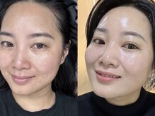 ブリエ(Brille)/細胞レベルにアプローチ◎