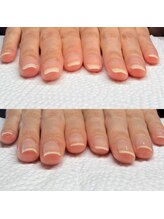 ウェルズユキ(well's yuki)/爪の悩み町田