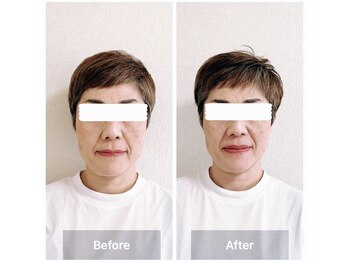 ラニ(Lani)/ドライヘッドスパ