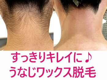 ドクターリバース(Dr.Reverse)/【うなじ脱毛】ワックス脱毛