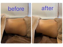 ニコリ(NICOLI)/腸もみビフォーアフター