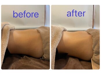 ニコリ(NICOLI)/腸もみビフォーアフター