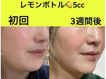 ベルフィーヌ ノーブル(BELLEFINE noble)の写真