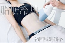 シュシュ(chouchou)