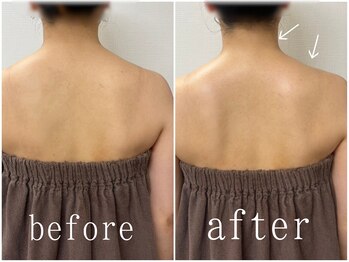 美人ヶ丘 長野店/小顔矯正,マッサージ,ヘッドスパ