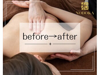 ノドカ 熊本駅前店(NODOKA)/before→after