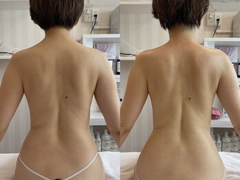 オリーブ(Olive)の写真/冷えや肩こりで辛い方にもオススメ！完全個室のリラックス空間でガチガチ首肩をスッキリしませんか？