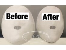 美極 銀座店/銀座/小顔コルギ/小顔矯正