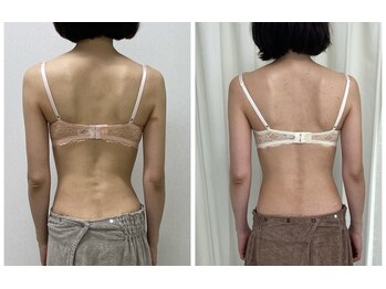 ワイサロン(Y salon)/40代/産後バストアップ/1年