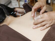 ジュンジュエル(JUNJEWEL)/全身鍼灸