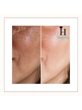 ハピネス 心斎橋アメリカ村本店(Happiness)/