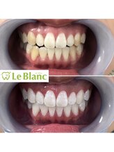 ルブラン 奈良店(Le Blanc)/歯のお悩み必ずあるはずです！