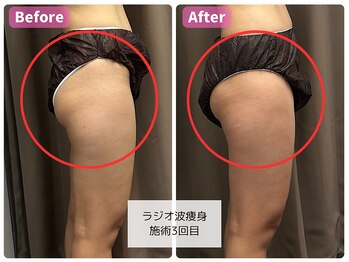 おにぎり(ONIGIRI)/★お客様結果★