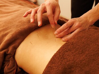 光幸はりきゅう院接骨院/症状に合わせた鍼☆肩こり・腰痛