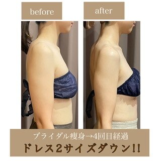 キー(Keee)|ホットペッパービューティー キー(Keee)|ホットペッパービューティー