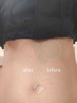 【光脱毛/WAX脱毛】doucek beauty/お腹 ワックス脱毛