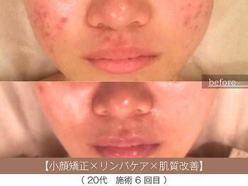 ホワイトカメリア(White Camellia)/肌質改善×小顔矯正