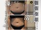 サロン ド パーフェクション(Salon de Perfection)の写真/運動が苦手な方必見!脂肪細胞だけを冷却して排出を促す最新マシン導入!切らずに気になる部分を狙い撃ち♪