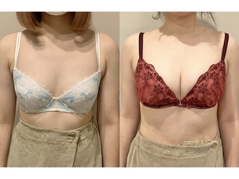 ティアモ(Ti Amo)/Before/After(3回目)