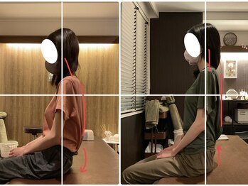 サクラ(SAKURA)/【30代】 BeforeAfter