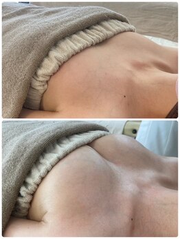 美人バスト 札幌店/バストアップ×育乳◇症例◇