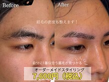 ビオプラス(BIO PLUS)