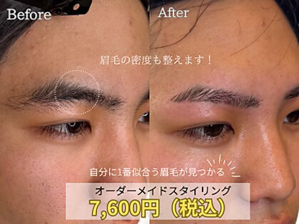 ビオプラス(BIO PLUS)の写真