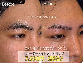 ビオプラス(BIO PLUS)
