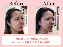 ココロ(COCORO)/美脳小顔矯正＆毛穴洗浄