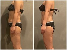 ツーアップ(2up)/ぽっこりお腹