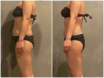 ツーアップ(2up)/ぽっこりお腹