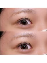 トラスト(Trust)/根元から丸みのある立ち上げ♪